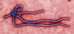 Electron micrograph of an Ebola virus virion. (Centers for Disease Control)